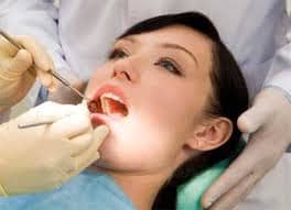 dental implants 22