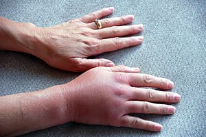 Home Remedies 01