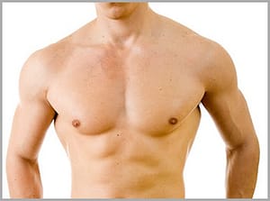 best Gynecomastia surgery 1
