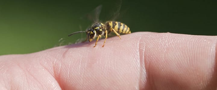 10 Common Insect Bite Home Remedies