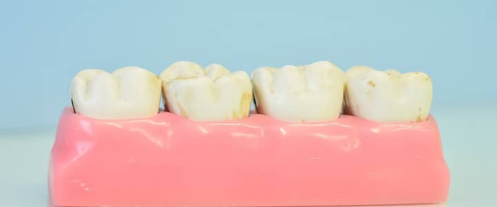 Factors To Consider When Establishing The Best Dentist