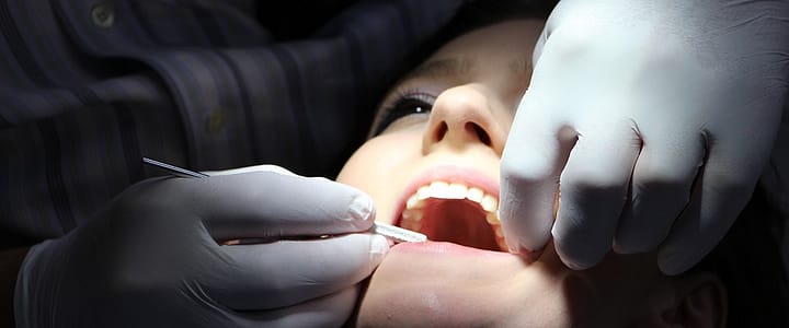 Types of Dental Implants